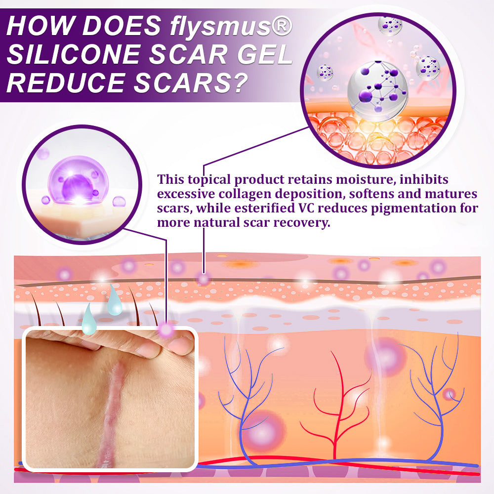 💜flysmus® cure FACE & BODY SCAR GEL