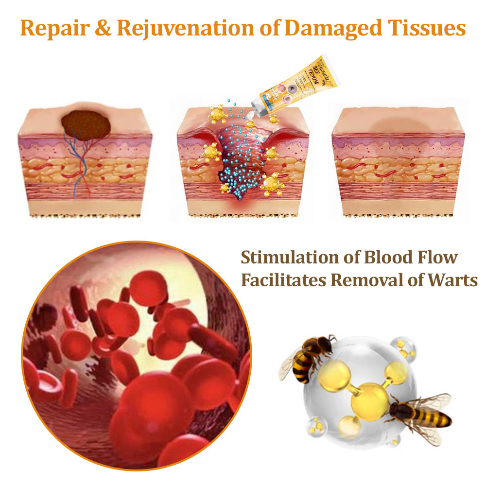 flysmus™Tagheal Bee Venom Mole and Wart Treatment Cream🐝(🔥 Last  day promotion 70% off🔥)