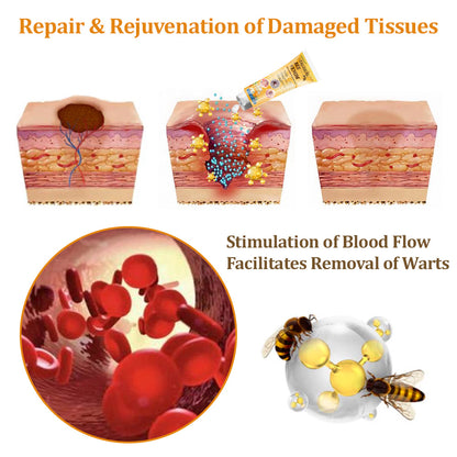flysmus™Tagheal Bee Venom Mole and Wart Treatment Cream🐝(🔥 Last  day promotion 70% off🔥)