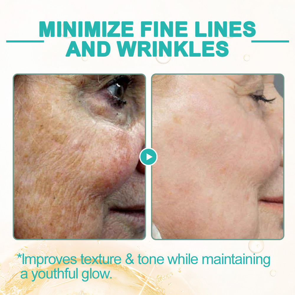 flysmus™ Collagen-Powered Firming Body Massage Oil(👩‍⚕️Targets Stretch Marks & Cellulite)