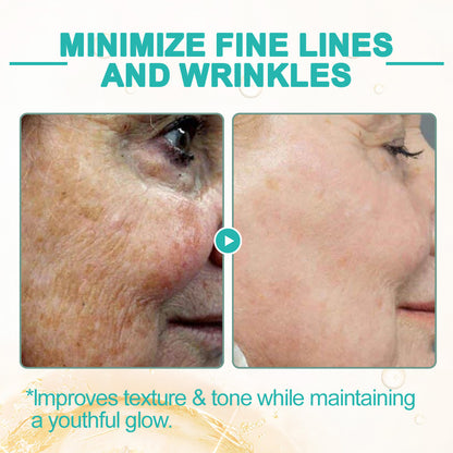 flysmus™ Collagen-Powered Firming Body Massage Oil(👩‍⚕️Targets Stretch Marks & Cellulite)