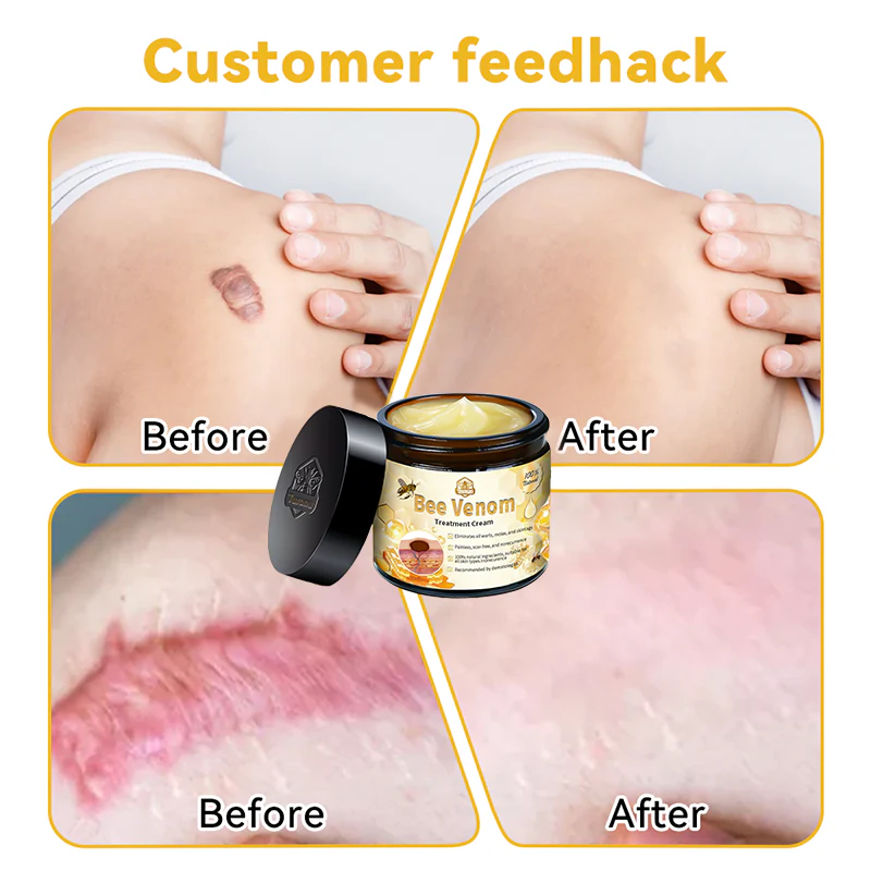 🌿🐝Turonu™ Bee Venom Skin Treatment Cream (✅ Meets UK Dermatology Standards)
