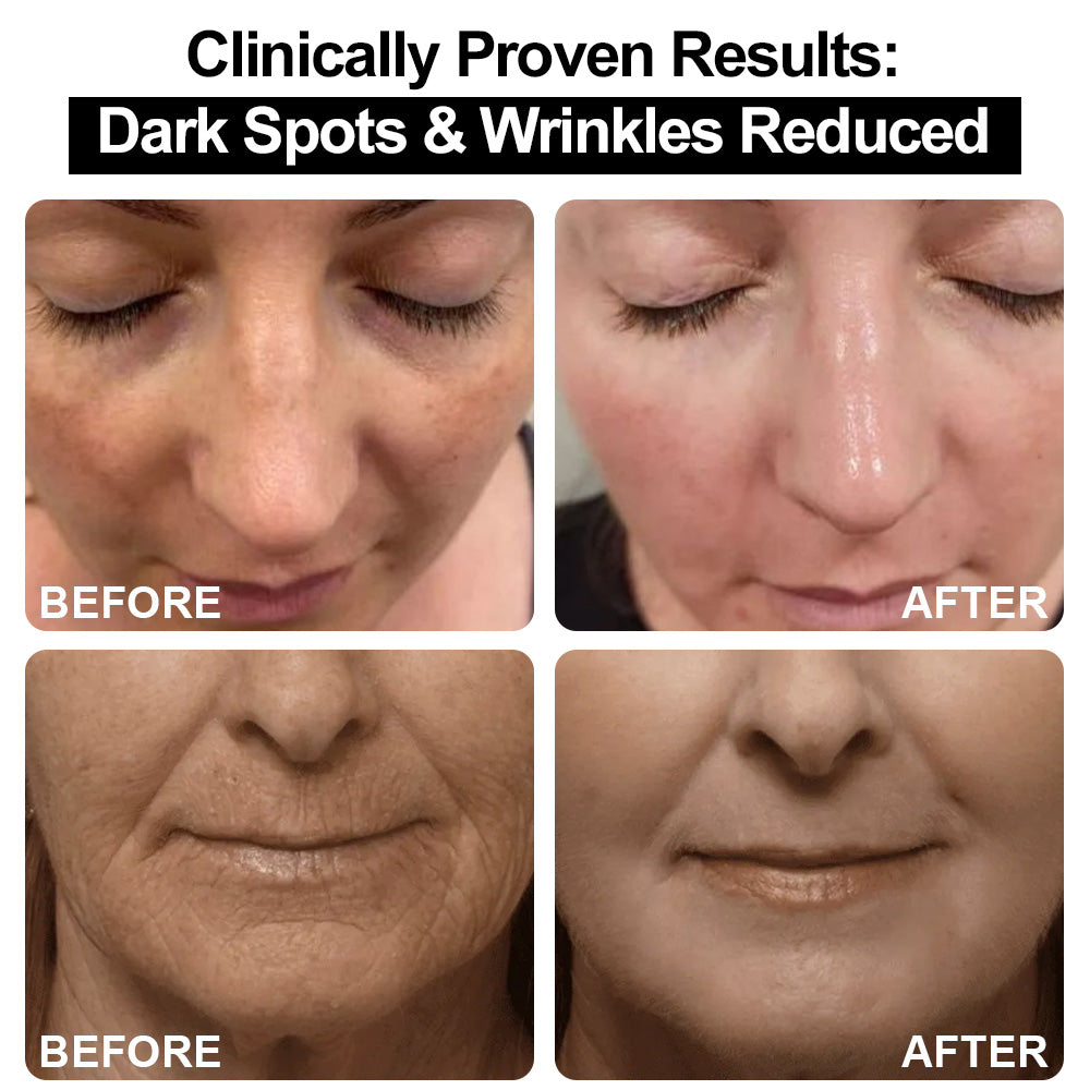 UK 🧑‍⚕️ 𝐙𝐯𝐨𝐞𝐯𝐨® Confidence in a Cream – Hydrating & Age-Defying Face Moisturiser, Visibly Reduces Fine Lines & Wrinkles