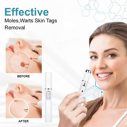 👨‍⚕️Bikenda® Medical-Grade Wart Removal Laser Pen