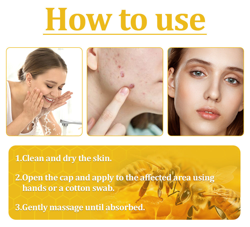🌿🐝Turonu™ Bee Venom Skin Treatment Cream (✅ Meets UK Dermatology Standards)