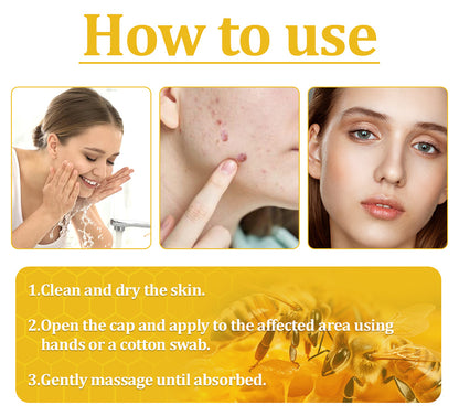🌿🐝Turonu™ Bee Venom Skin Treatment Cream (✅ Meets UK Dermatology Standards)