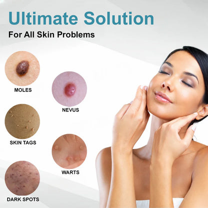 👨‍⚕️Bikenda® Medical-Grade Wart Removal Laser Pen