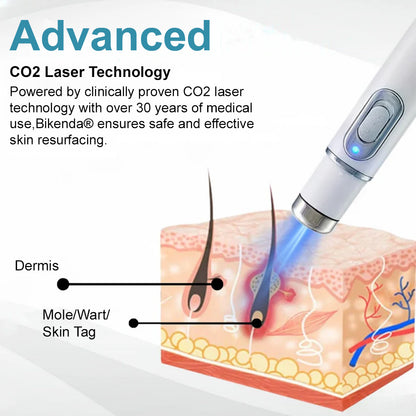 👨‍⚕️Bikenda® Medical-Grade Wart Removal Laser Pen