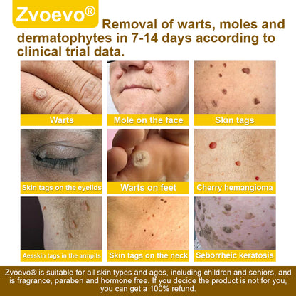 🐝𝐳𝐯𝐨𝐞𝐯𝐨® 𝐁𝐞𝐞 𝐕𝐞𝐧𝐨𝐦 𝐒𝐤𝐢𝐧 𝐒𝐩𝐫𝐚𝐲 – Dermatologist-recommended, provides effective relief for stubborn warts, skin bumps, infections, scars, and various skin concerns.