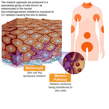 🐝𝐳𝐯𝐨𝐞𝐯𝐨® 𝐁𝐞𝐞 𝐕𝐞𝐧𝐨𝐦 𝐒𝐤𝐢𝐧 𝐒𝐩𝐫𝐚𝐲 – Dermatologist-recommended, provides effective relief for stubborn warts, skin bumps, infections, scars, and various skin concerns.