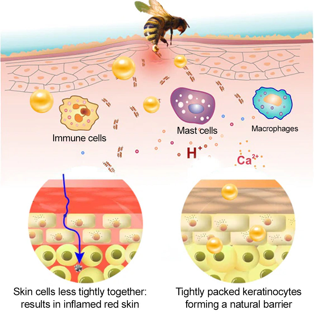🐝𝐳𝐯𝐨𝐞𝐯𝐨® 𝐁𝐞𝐞 𝐕𝐞𝐧𝐨𝐦 𝐒𝐤𝐢𝐧 𝐒𝐩𝐫𝐚𝐲 – Dermatologist-recommended, provides effective relief for stubborn warts, skin bumps, infections, scars, and various skin concerns.