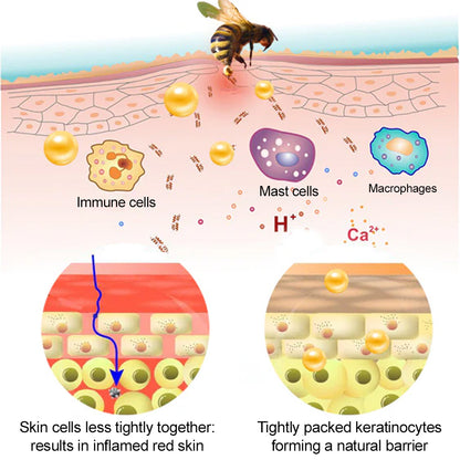 🐝𝐳𝐯𝐨𝐞𝐯𝐨® 𝐁𝐞𝐞 𝐕𝐞𝐧𝐨𝐦 𝐒𝐤𝐢𝐧 𝐒𝐩𝐫𝐚𝐲 – Dermatologist-recommended, provides effective relief for stubborn warts, skin bumps, infections, scars, and various skin concerns.