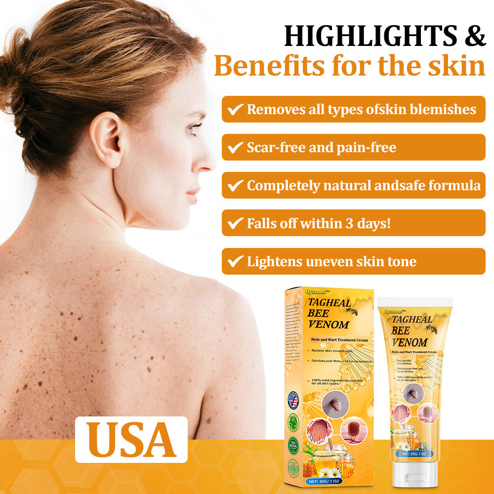 flysmus™Tagheal Bee Venom Mole and Wart Treatment Cream🐝(🔥 Last  day promotion 70% off🔥)