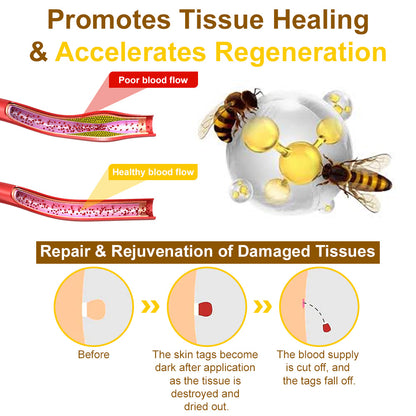 🐝𝐳𝐯𝐨𝐞𝐯𝐨® 𝐁𝐞𝐞 𝐕𝐞𝐧𝐨𝐦 𝐒𝐤𝐢𝐧 𝐒𝐩𝐫𝐚𝐲 – Dermatologist-recommended, provides effective relief for stubborn warts, skin bumps, infections, scars, and various skin concerns.