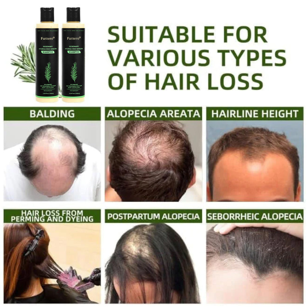 🔥LAST DAY 50% OFF - 🌿Furzero® Organic Rosemary Hair Growth Shampoo