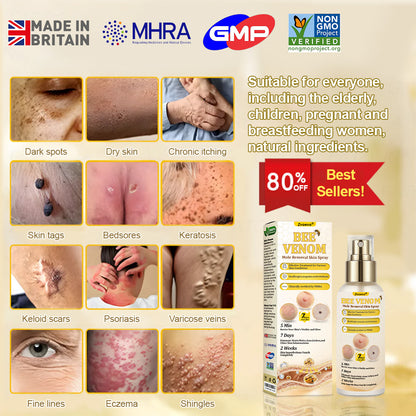 🐝𝐳𝐯𝐨𝐞𝐯𝐨® 𝐁𝐞𝐞 𝐕𝐞𝐧𝐨𝐦 𝐒𝐤𝐢𝐧 𝐒𝐩𝐫𝐚𝐲 – Dermatologist-recommended, provides effective relief for stubborn warts, skin bumps, infections, scars, and various skin concerns.