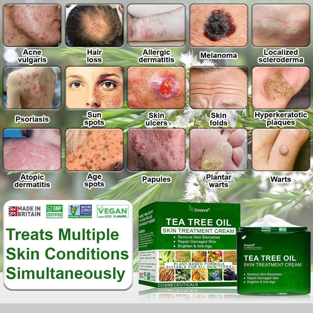 ✅𝐌𝐇𝐑𝐀-𝐀𝐏𝐏𝐑𝐎𝐕𝐄𝐃 🌿𝐳𝐯𝐨𝐞𝐯𝐨® 𝐓𝐞𝐚 𝐓𝐫𝐞𝐞 𝐎𝐢𝐥 𝐒𝐤𝐢𝐧 𝐓𝐫𝐞𝐚𝐭𝐦𝐞𝐧𝐭 𝐂𝐫𝐞𝐚𝐦 – Removes Skin Blemishes, Repairs Damaged Skin, Brightens & Anti-Ageing Care