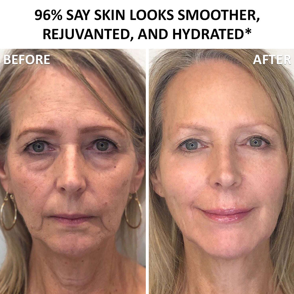 UK 🧑‍⚕️ 𝐙𝐯𝐨𝐞𝐯𝐨® Confidence in a Cream – Hydrating & Age-Defying Face Moisturiser, Visibly Reduces Fine Lines & Wrinkles