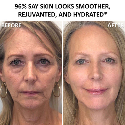 UK 🧑‍⚕️ 𝐙𝐯𝐨𝐞𝐯𝐨® Confidence in a Cream – Hydrating & Age-Defying Face Moisturiser, Visibly Reduces Fine Lines & Wrinkles