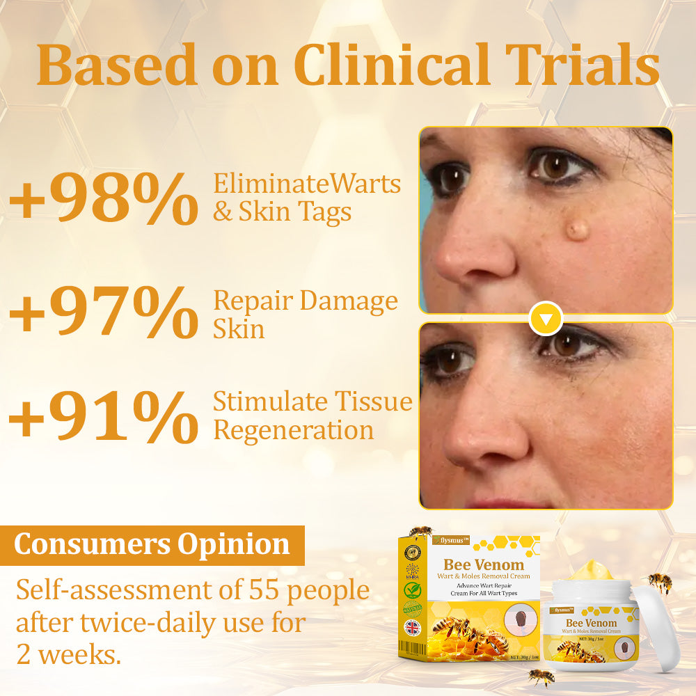 flysmus™ TagCure Bee Venom Wart & Moles Removal Cream🐝