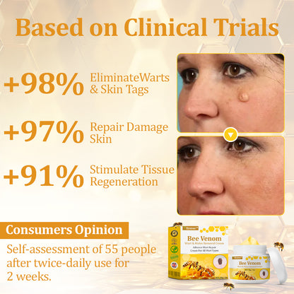 flysmus™ TagCure Bee Venom Wart & Moles Removal Cream🐝