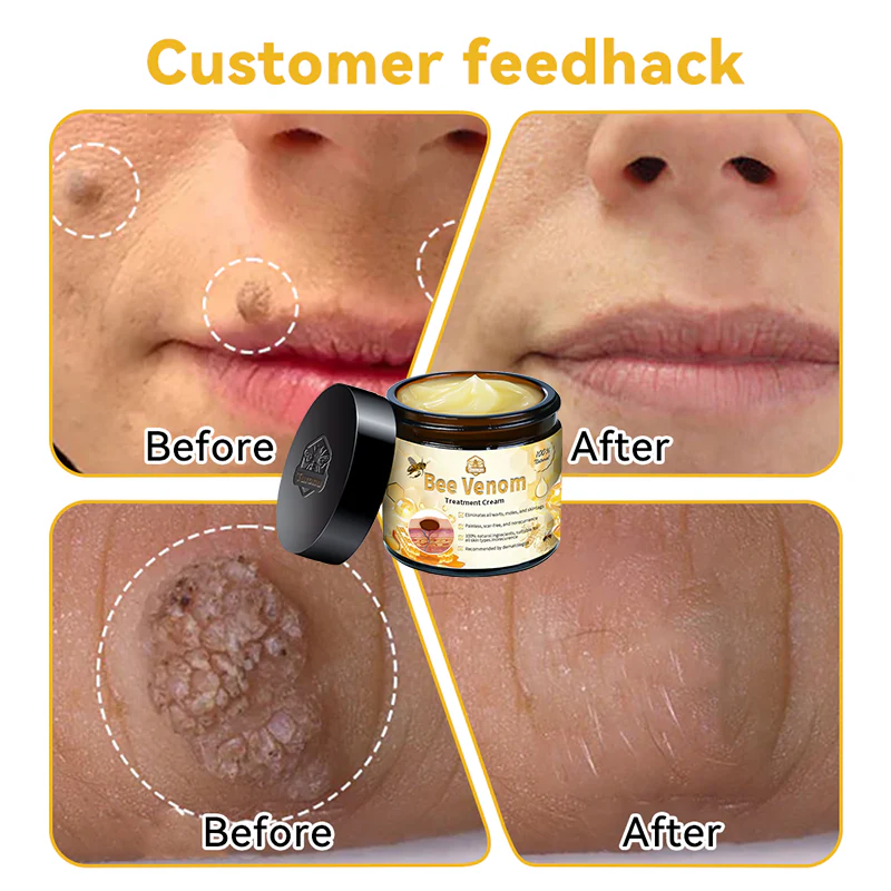 🌿🐝Turonu™ Bee Venom Skin Treatment Cream (✅ Meets UK Dermatology Standards)