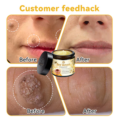 🌿🐝Turonu™ Bee Venom Skin Treatment Cream (✅ Meets UK Dermatology Standards)