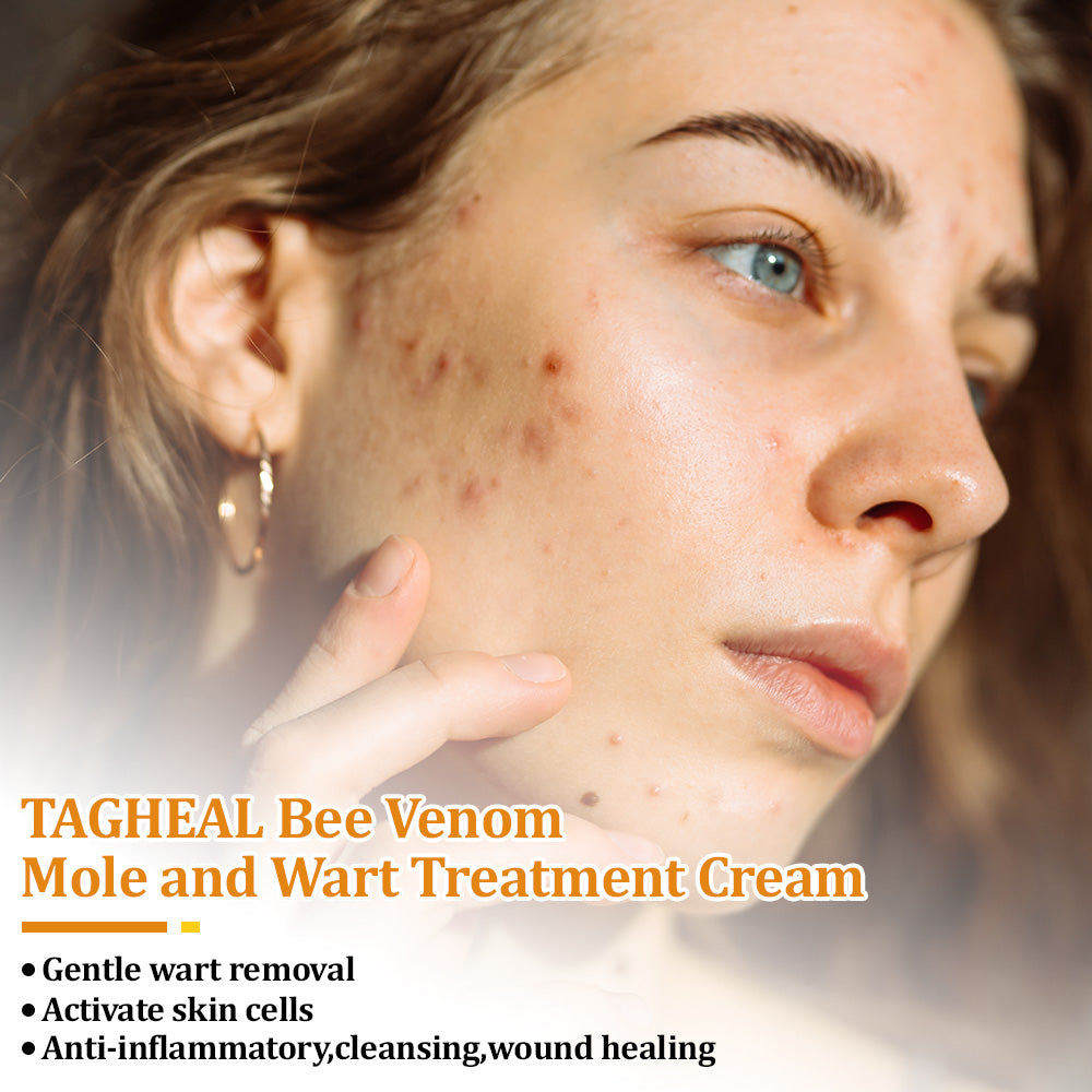flysmus™Tagheal Bee Venom Mole and Wart Treatment Cream🐝(🔥 Last  day promotion 70% off🔥)