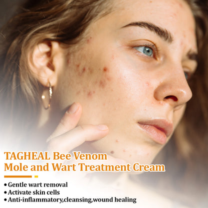 flysmus™Tagheal Bee Venom Mole and Wart Treatment Cream🐝(🔥 Last  day promotion 70% off🔥)