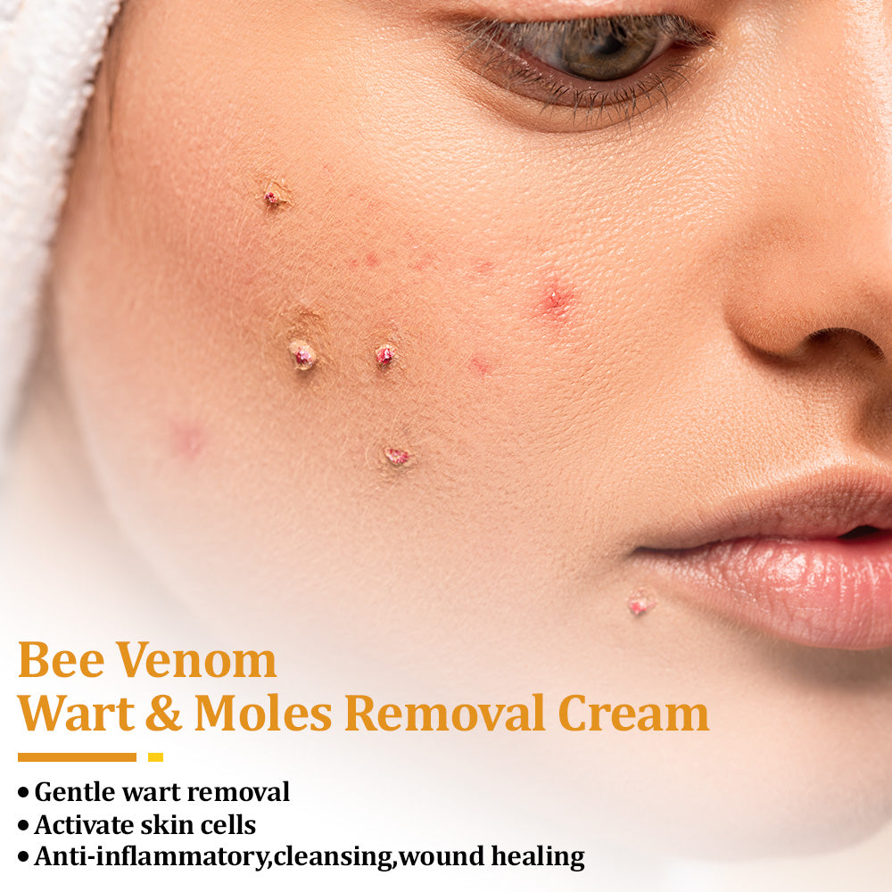 flysmus™ TagCure Bee Venom Wart & Moles Removal Cream🐝