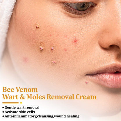 flysmus™ TagCure Bee Venom Wart & Moles Removal Cream🐝