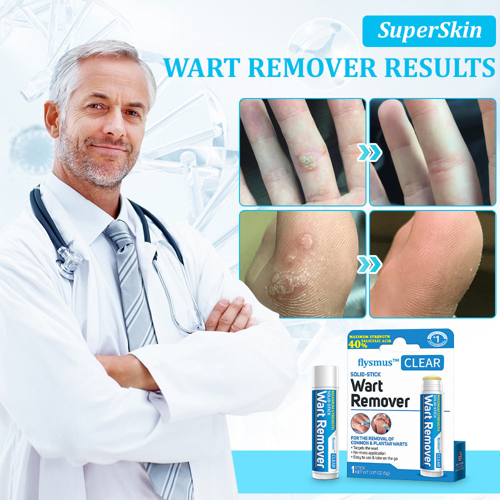 flysmus™ WartStick Maximum Strength Salicylic Acid Solid Stick
