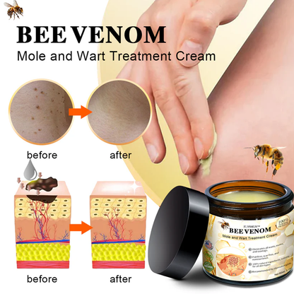 🌿🌿flysmus™ Bee Venom Mole and Wart Treatment Cream (AAD RECOMMENDS)