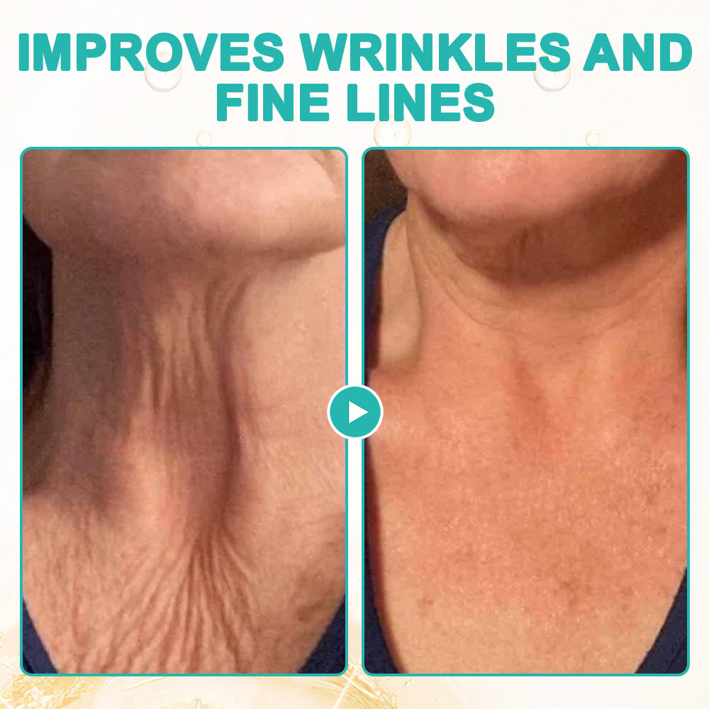 flysmus™ Collagen-Powered Firming Body Massage Oil(👩‍⚕️Targets Stretch Marks & Cellulite)