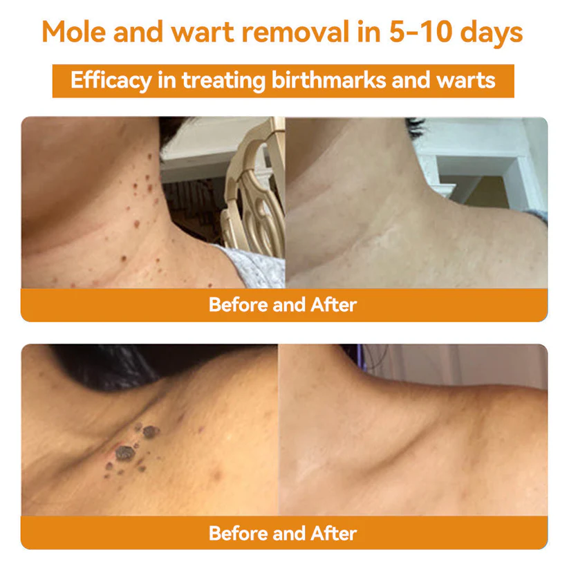 🌿🐝Turonu™ Bee Venom Skin Treatment Cream (✅ Meets UK Dermatology Standards)