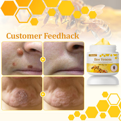 flysmus™ TagCure Bee Venom Wart & Moles Removal Cream🐝
