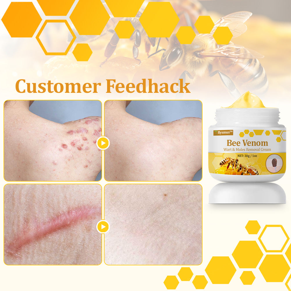 flysmus™ TagCure Bee Venom Wart & Moles Removal Cream🐝
