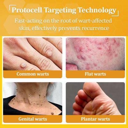 💙𝐌𝐇𝐑𝐀-𝐀𝐏𝐏𝐑𝐎𝐕𝐄𝐃 🐝𝐟𝐥𝐲𝐬𝐦𝐮𝐬® 𝐁𝐞𝐞 𝐕𝐞𝐧𝐨𝐦 𝐀𝐥𝐥-𝐢𝐧-𝐎𝐧𝐞 𝐂𝐫𝐞𝐚𝐦 – Provides effective relief for stubborn warts, skin bumps, lesions, infections, and scars.Up