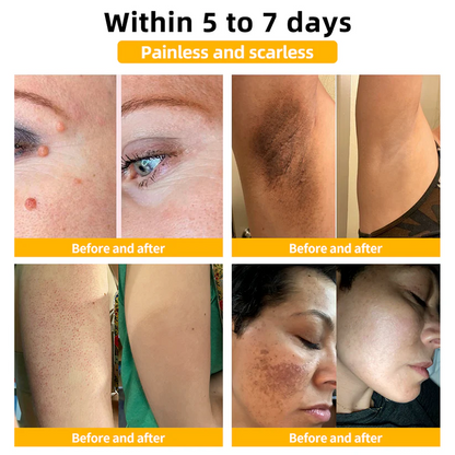 🌿🐝Turonu™ Bee Venom Skin Treatment Cream (✅ Meets UK Dermatology Standards)