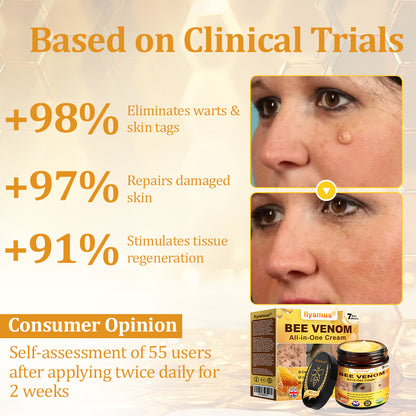 💙𝐌𝐇𝐑𝐀-𝐀𝐏𝐏𝐑𝐎𝐕𝐄𝐃 🐝𝐟𝐥𝐲𝐬𝐦𝐮𝐬® 𝐁𝐞𝐞 𝐕𝐞𝐧𝐨𝐦 𝐀𝐥𝐥-𝐢𝐧-𝐎𝐧𝐞 𝐂𝐫𝐞𝐚𝐦 – Provides effective relief for stubborn warts, skin bumps, lesions, infections, and scars.Up