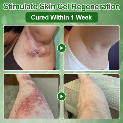 ✅𝐌𝐇𝐑𝐀-𝐀𝐏𝐏𝐑𝐎𝐕𝐄𝐃 🌿𝐳𝐯𝐨𝐞𝐯𝐨® 𝐓𝐞𝐚 𝐓𝐫𝐞𝐞 𝐎𝐢𝐥 𝐒𝐤𝐢𝐧 𝐓𝐫𝐞𝐚𝐭𝐦𝐞𝐧𝐭 𝐂𝐫𝐞𝐚𝐦 – Removes Skin Blemishes, Repairs Damaged Skin, Brightens & Anti-Ageing Care