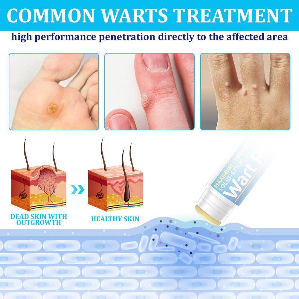 flysmus™ WartStick Maximum Strength Salicylic Acid Solid Stick