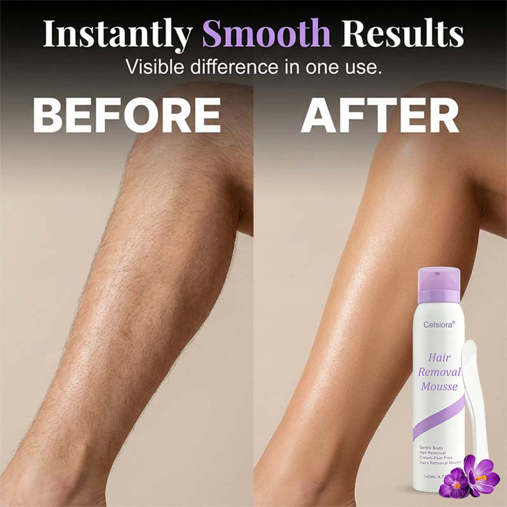 up🥰Celsiora® Hair Removal Foam Spray - Smooth Skin In Minutes Without Razors, Pain, Or Stubble