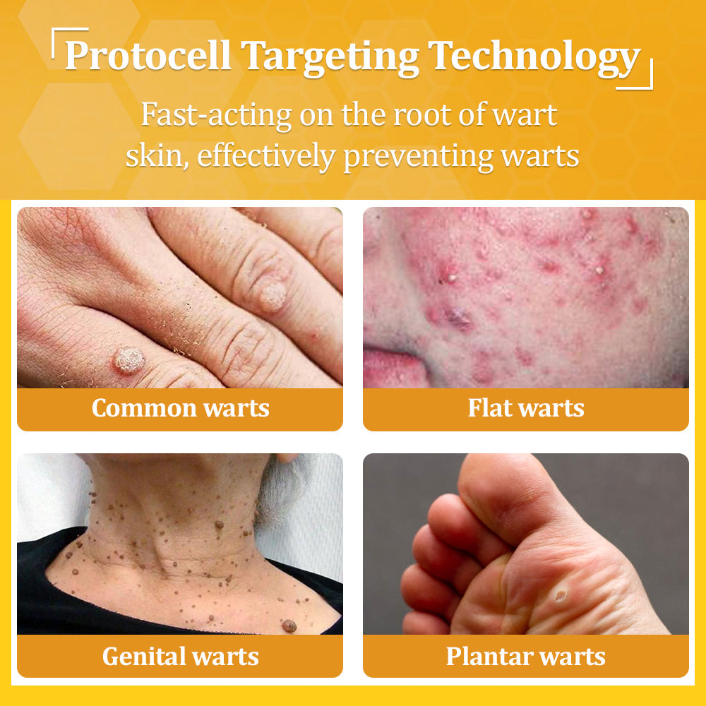 flysmus™ TagCure Bee Venom Wart & Moles Removal Cream🐝