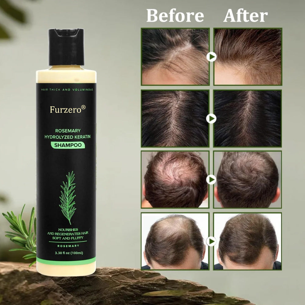 🔥LAST DAY 50% OFF - 🌿Furzero® Organic Rosemary Hair Growth Shampoo