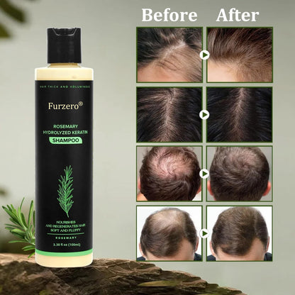 🔥LAST DAY 50% OFF - 🌿Furzero® Organic Rosemary Hair Growth Shampoo