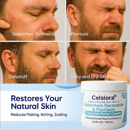 🌿Scalp & Beard Comfort Cream Steroid-Free Botanical Formula with Kudzu Root