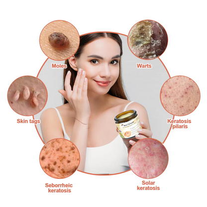 🌿🌿flysmus™ Bee Venom Mole and Wart Treatment Cream (AAD RECOMMENDS)